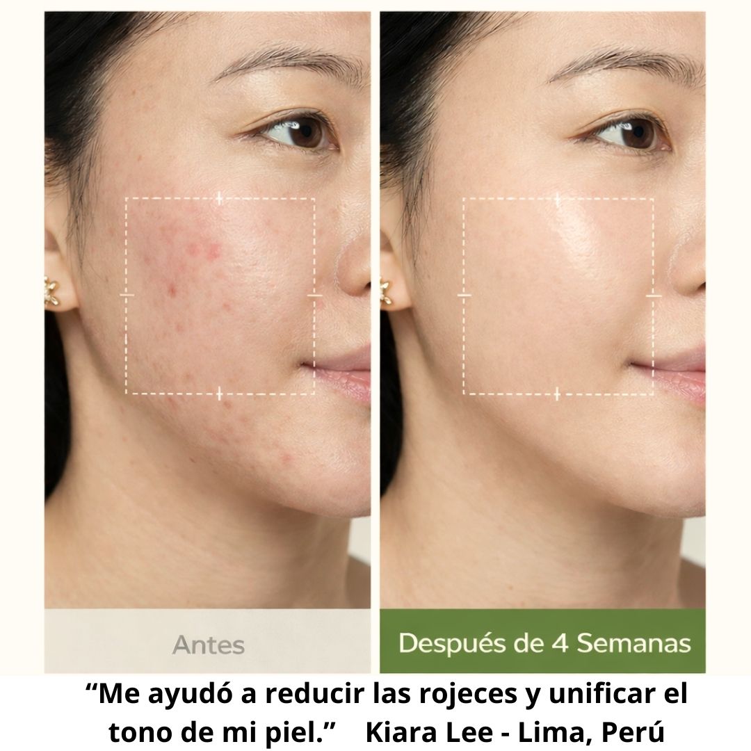 NONI EXTRACT (30 ML)